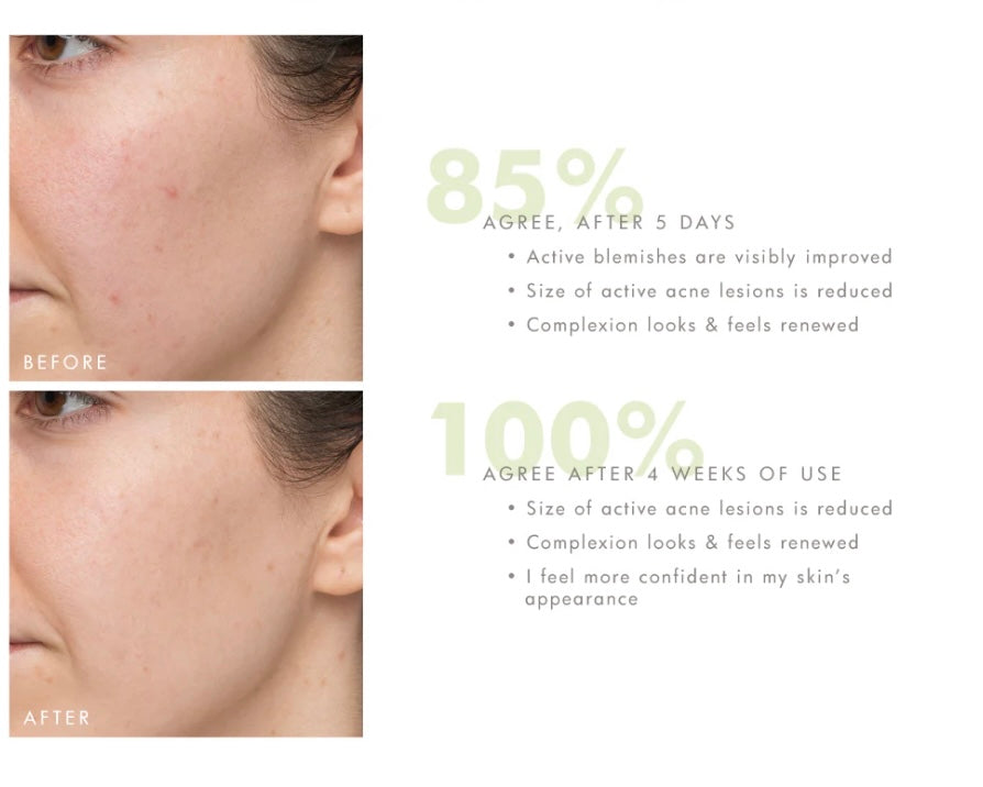 FHF Crisp Start Salicylic Acid acne wash